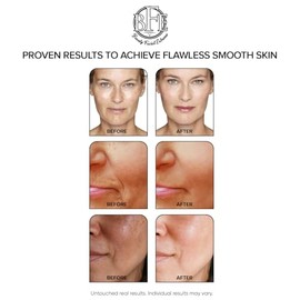 Glycolic Acid 15% Anti-Wrinkle Cream- Extra strength, Alpha Hydroxy Acid enhanced with Green Tea Extract that improves your complexion as it safely and aggressively smoothes out fine lines and wrinkles.