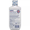 biotène Biotene Dry Mouth Management Kit Mouthwash Spray Gel Oral