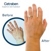 Cetraben Body Lotion Perfect for Dry Sensitive or Eczema Skin