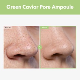 TOSOWOONG Green Caviar Pore Ampoule With 2,500ppm Green Caviar, Niacinamide, Hydrating, Firming, Korean Skin Care, 33ml, 1.11 fl.oz.