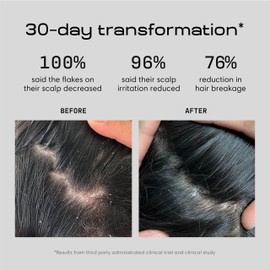 Jupiter Anti Dandruff Shampoo - Shampoo for Men & Women for Flaky, Itchy, Oily, & Dry Scalp - Nourishes Scalp and Reduces Breakage & Flakes - Color-Safe, Sulfate-Free, Paraben-Free