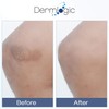 Vitamin K Cream- Moisturizing Bruise Healing Formula. Dark Spot Corrector