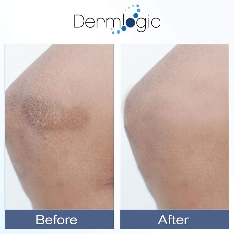 Vitamin K Cream- Moisturizing Bruise Healing Formula. Dark Spot Corrector