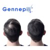 Loción Anticaída Y Crecimiento Capilar Gennepil 125ml