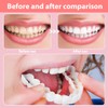 EIHI 6 sets of tooth shields for attaching, teeth for