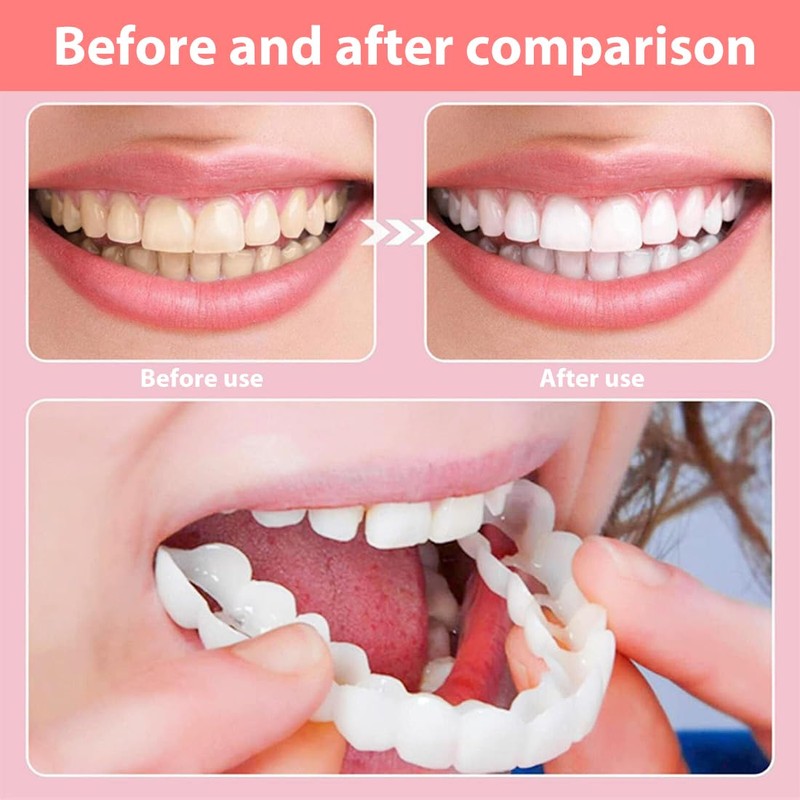 EIHI 6 sets of tooth shields for attaching, teeth for