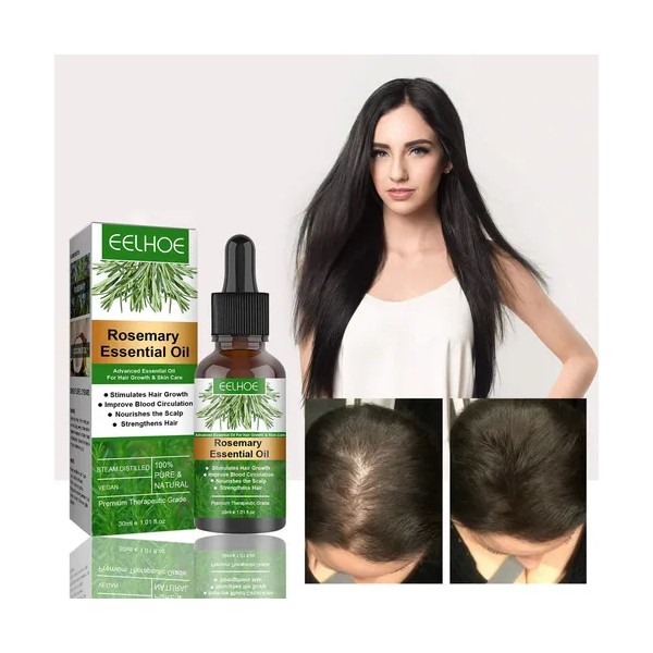 Pelo Aceite De Romero Para El Crecimiento Del Cabello, Suero