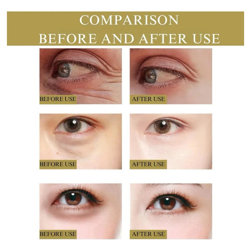 Parches Microagujas Nano Ojos