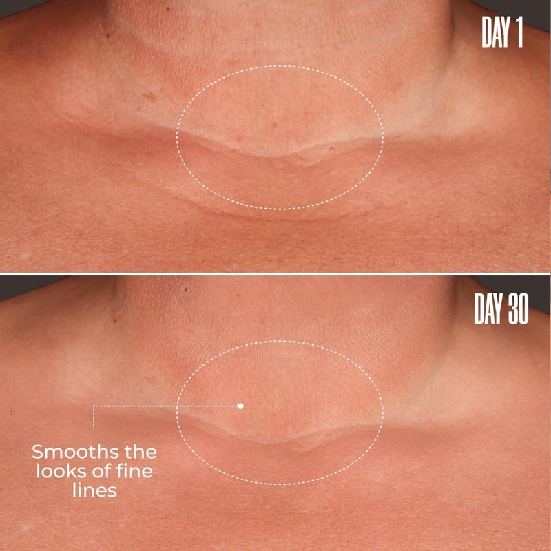 MAËLYS B-GLOSSY Smoothing Body Serum - Anti-Aging Hyaluronic Acid Serum