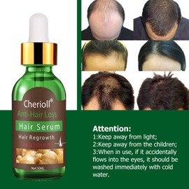 Hair Growth Serum, Hair Loss Treatment, Hair Serum Stimulates New Hair Growth, Promotes Thicker, Fuller and Faster Growing Hair