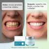 Polvo de Colgeno para Encas, Colgeno en Polvo para Dientes,