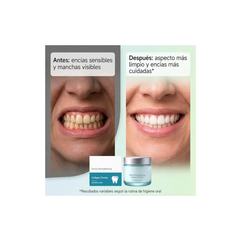 Polvo de Colgeno para Encas, Colgeno en Polvo para Dientes,