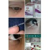 IRIAZ MOLE CREAM BUANG TAHI LALAT KUTIL BIJI KOLESTEROL