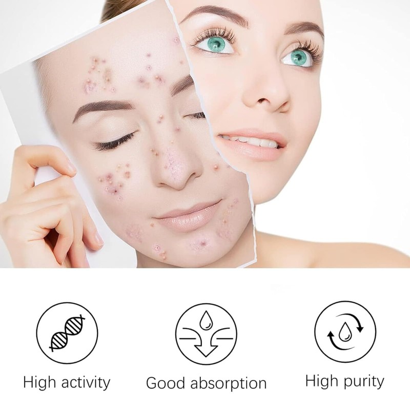 Crema para Manchas Oscuras en La Cara, Cremas para Quitar