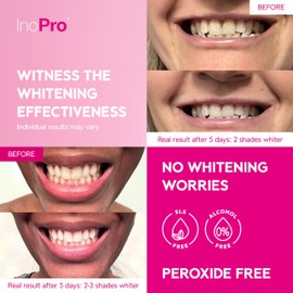 InoPro InoPro Teeth Whitening Strips 14 Treatments Kit - Sensitive Teeth Whitener, Peroxide Free, Enamel Safe Green White Strips, Deep Stains Removal - Instant Teeth Whitening Without The Harm (28 Strips)