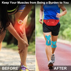 Hossom Kinesiotapes for Knees, Pack of 10 Tape Sport Pre-Cut for Knee Pain, Elastic Kinesiology Tape, Skin-Friendly with Perfect Wearing Comfort, Waterproof for Knee Pain Relief