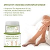 Crema de venas varicosas, crema reparadora de araas vasculares, tratamiento