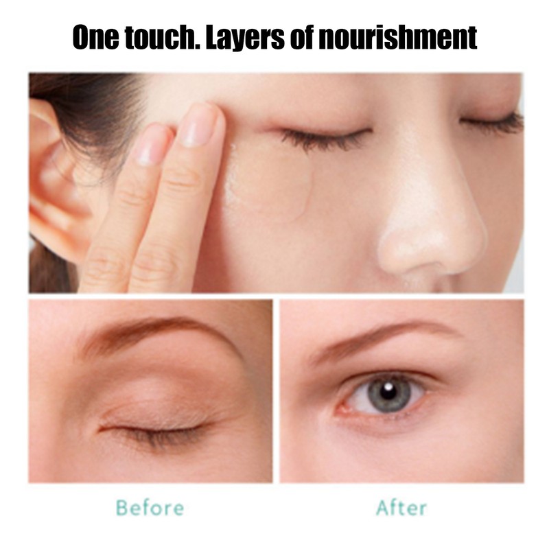 MELAO Eye Cream Moisturizing Soothing Eye Cream Gel for Puffy