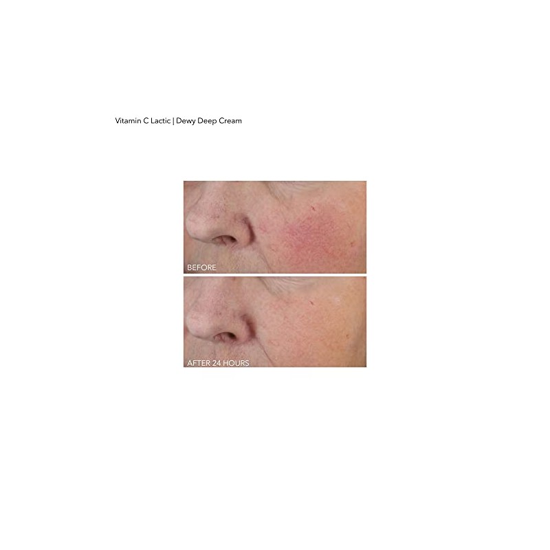 Vitamin C Plus Lactic Firm and Bright Eye Treatment by