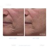Dr. Denese Collagen Firming Peel Off Mask | 4 FL
