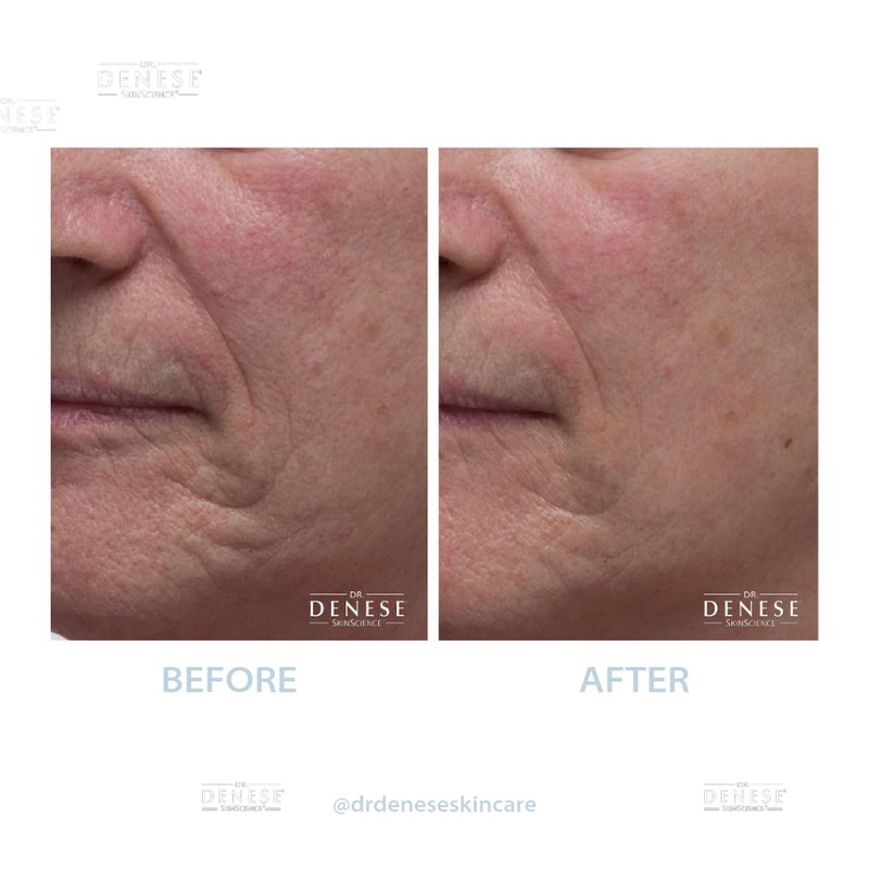 Dr. Denese Collagen Firming Peel Off Mask | 4 FL