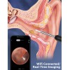 VITCOCO 2000mAh Ear Wax Cleaner – 1080P HD Camera, 4