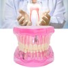 Transparent Adult Teeth Model Pathological Repair Studying Dental Teaching Tools