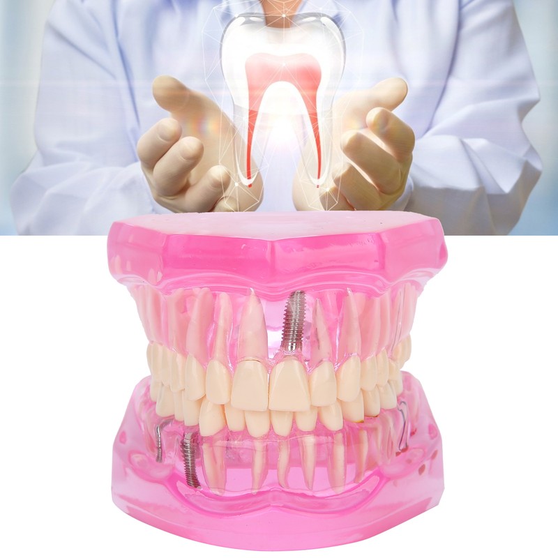 Transparent Adult Teeth Model Pathological Repair Studying Dental Teaching Tools