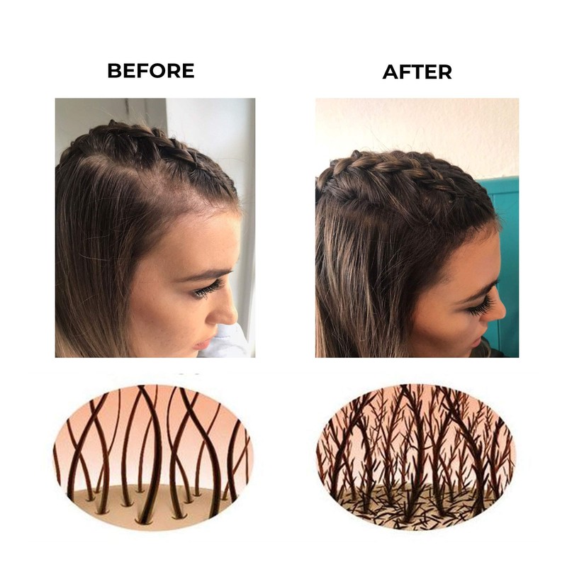 Hair Fibres by Keratech Pro 12ml | Instantly Fuller Hair