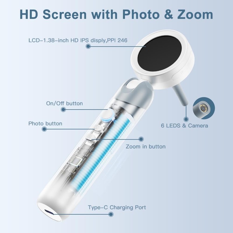 Aspoven Otoscope Ear Camera with Light, 1.4” Screen 1080P HD