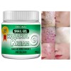 Acné Gel Caracol Crema Hecho EE. UU. Antiarrugas Soporte Cicatriz