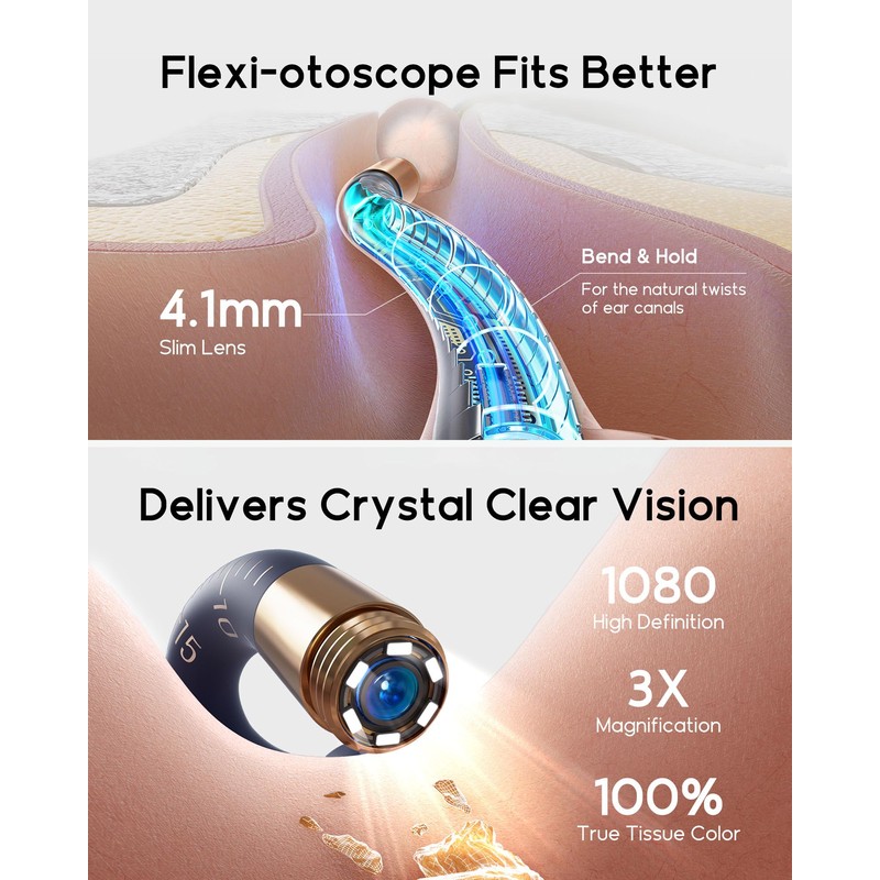 Bebird Smart Otoscope Set – Earsight Plus Otoscope with 1920P