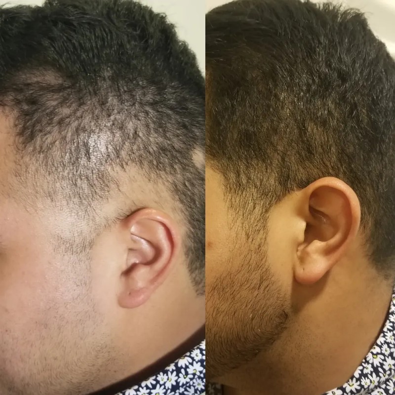 Shampoo Reviving Farmasi /con Ajo , Capixyl Y Trichogen