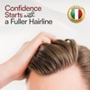 Foltene Pharma Hair and Sculp Treatment for Men - Value
