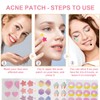 QOMJUFA Pimple Patch Pimple Patch Acne Patches Waterproof Breathable Acne