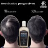 HR Hermoso Remedio Duo Shampoo Anticaida Crecimiento Reparador Cabello 7