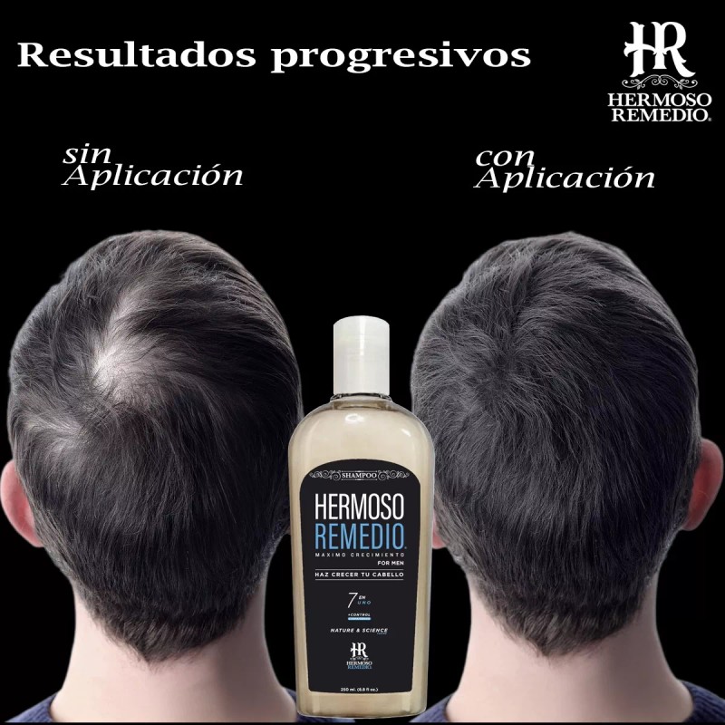 HR Hermoso Remedio Duo Shampoo Anticaida Crecimiento Reparador Cabello 7