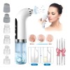 Limpiador Facial Eléctrico Succiona Puntos Negros Espinillas