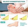Welnove Hammer Toe Corrector and Straightener - 8 Pcs Toe