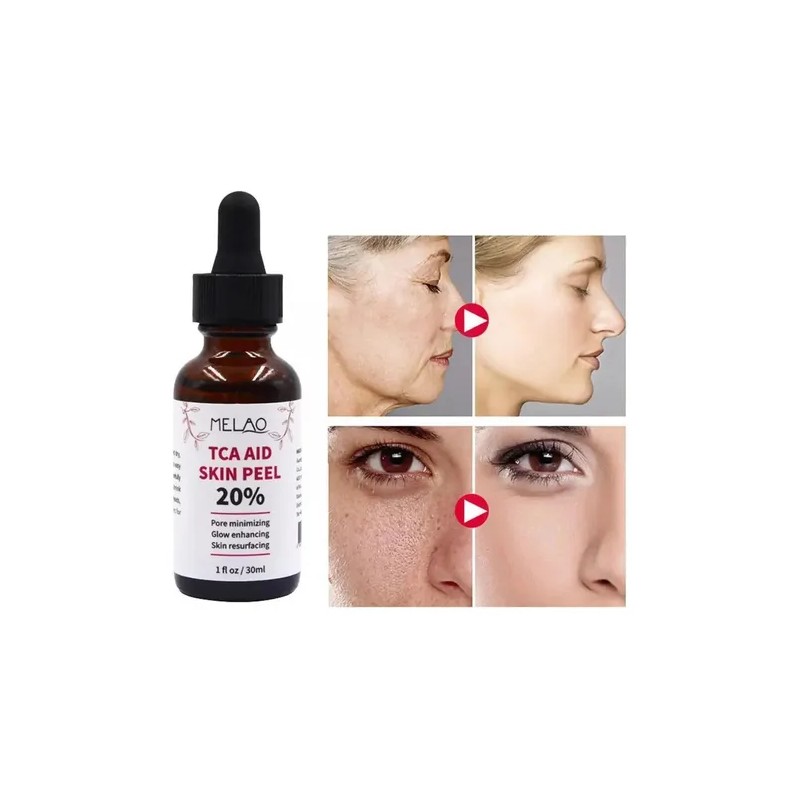 . 30 Ml De Tca Aid Exfoliante Para La Piel,