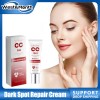 Crema Para Eliminar Manchas Oscuras Y Manchas Para Melasma Y