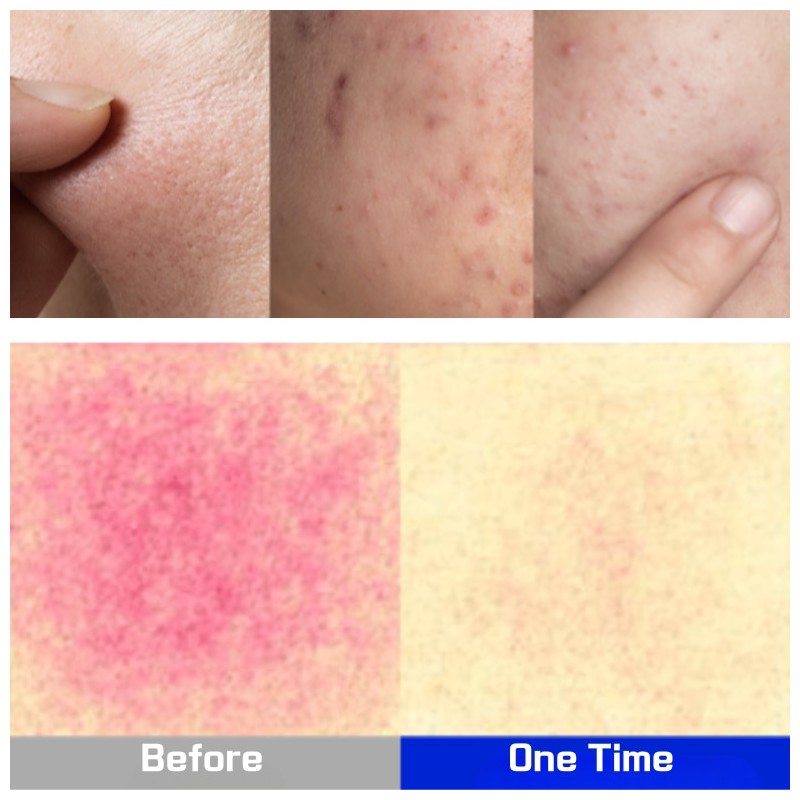 MILLIMILLI Medi Ampoule 15ml [Vita/Cica/Colla], Type:Colla-Glowing