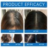 2PCS Scalp Serum, Hair Growth Serum for Women & Men,