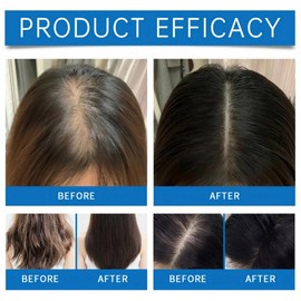 2PCS Scalp Serum, Hair Growth Serum for Women & Men, Scalp Cooling Hair Ampoule with Roller Lightweight, Non-Greasy & Refreshing Ampoule, Strengthening Soothing