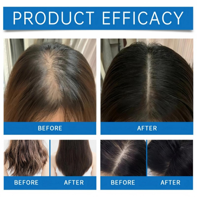 2PCS Scalp Serum, Hair Growth Serum for Women & Men,