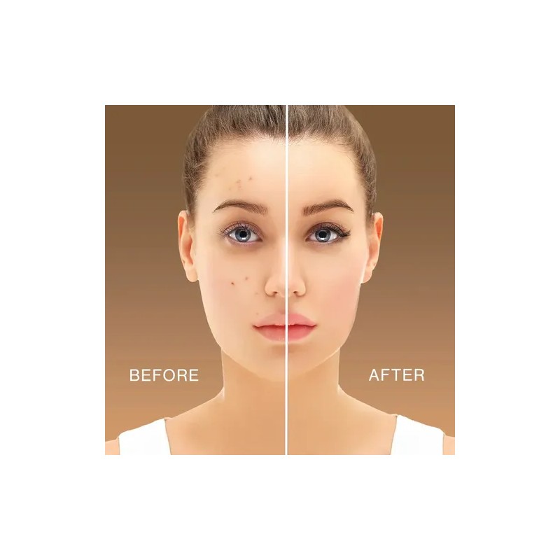 Corrector Maquillaje Liquido La Girl Hd Pro Concealer 8 G