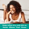 GILDEN TREE Urea Gel 42 Percent For Feet Maximum Strength