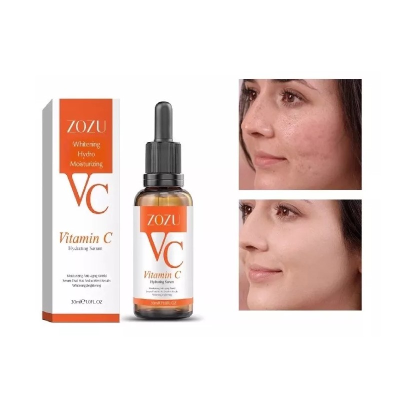 Zozu Serum Vitamina C Original Elimina Manchas Paño Pecas Hidrata