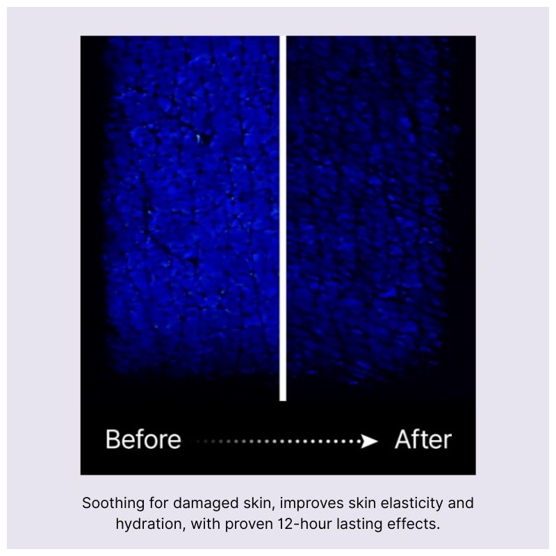 MEDIANSWER Calming Collagen Nano Shot Mask 37g*5ea