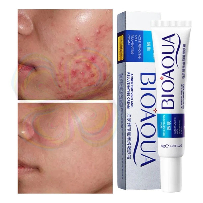 Crema Cicatrices Poros Control De Grasa Acne Cream 2pz Full